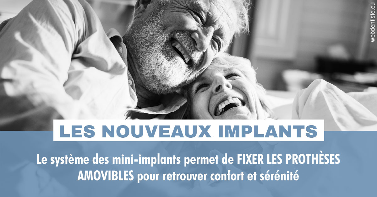 https://selarl-smile.chirurgiens-dentistes.fr/Les nouveaux implants 2