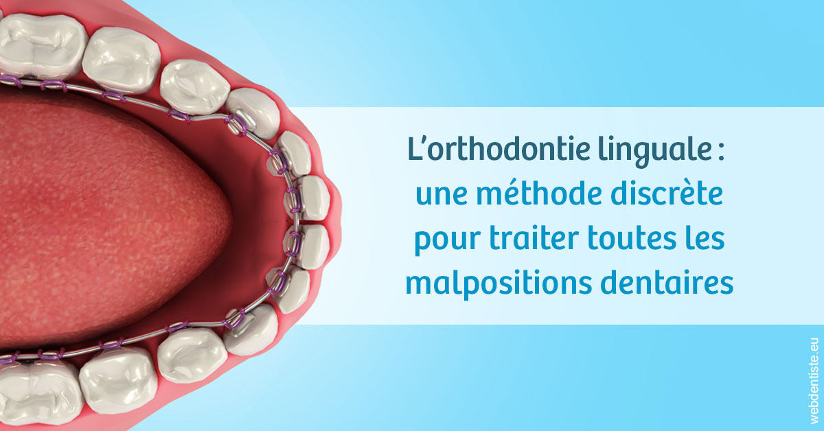 https://selarl-smile.chirurgiens-dentistes.fr/L'orthodontie linguale 1
