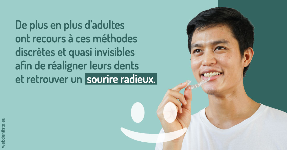 https://selarl-smile.chirurgiens-dentistes.fr/Gouttières sourire radieux 2