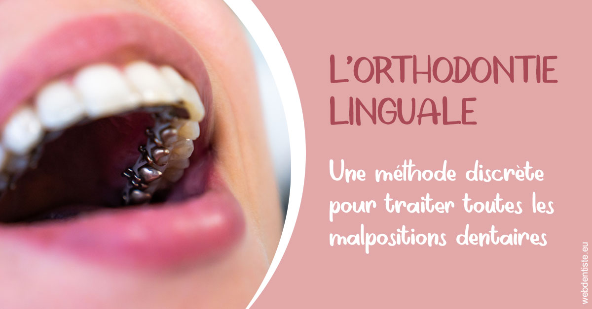 https://selarl-smile.chirurgiens-dentistes.fr/L'orthodontie linguale 2