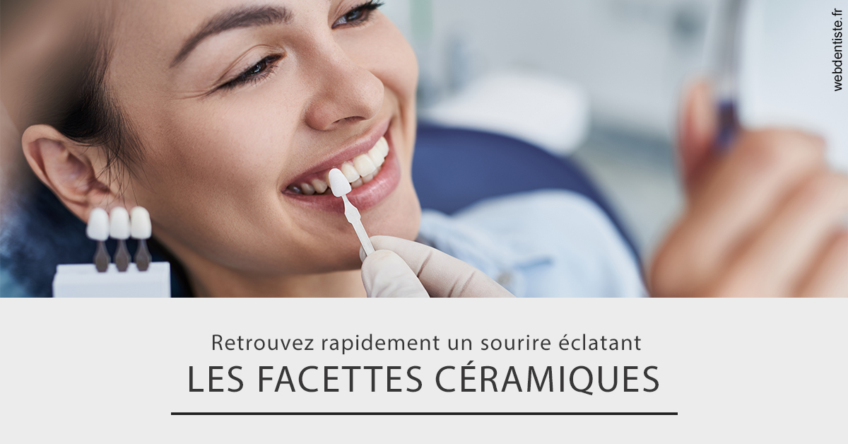 https://selarl-smile.chirurgiens-dentistes.fr/Les facettes céramiques 2