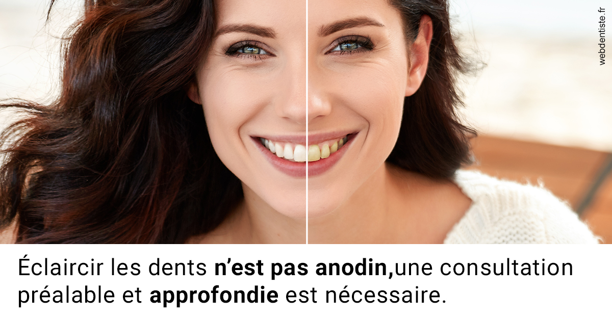 https://selarl-smile.chirurgiens-dentistes.fr/Le blanchiment 2
