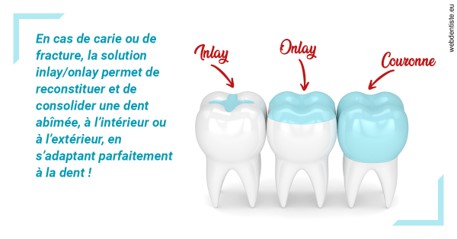 https://selarl-smile.chirurgiens-dentistes.fr/L'INLAY ou l'ONLAY