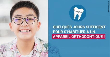 https://selarl-smile.chirurgiens-dentistes.fr/L'appareil orthodontique