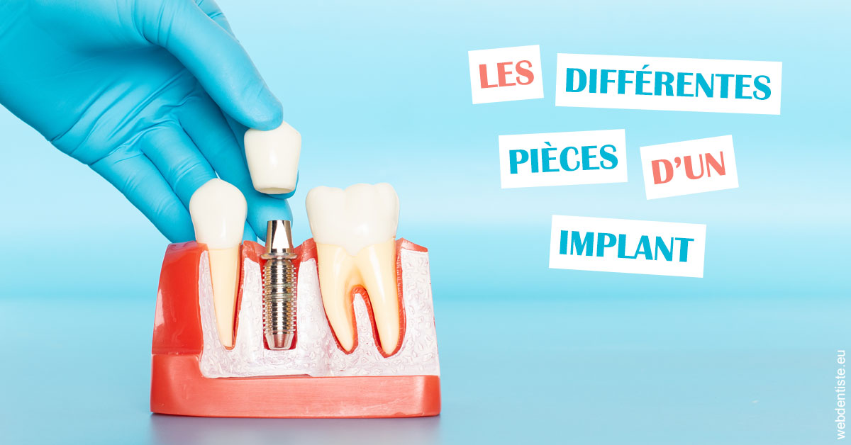https://selarl-smile.chirurgiens-dentistes.fr/Les différentes pièces d’un implant 2