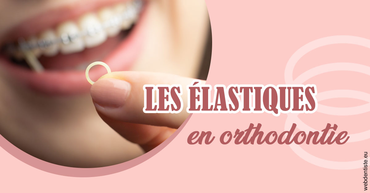 https://selarl-smile.chirurgiens-dentistes.fr/Elastiques orthodontie 1