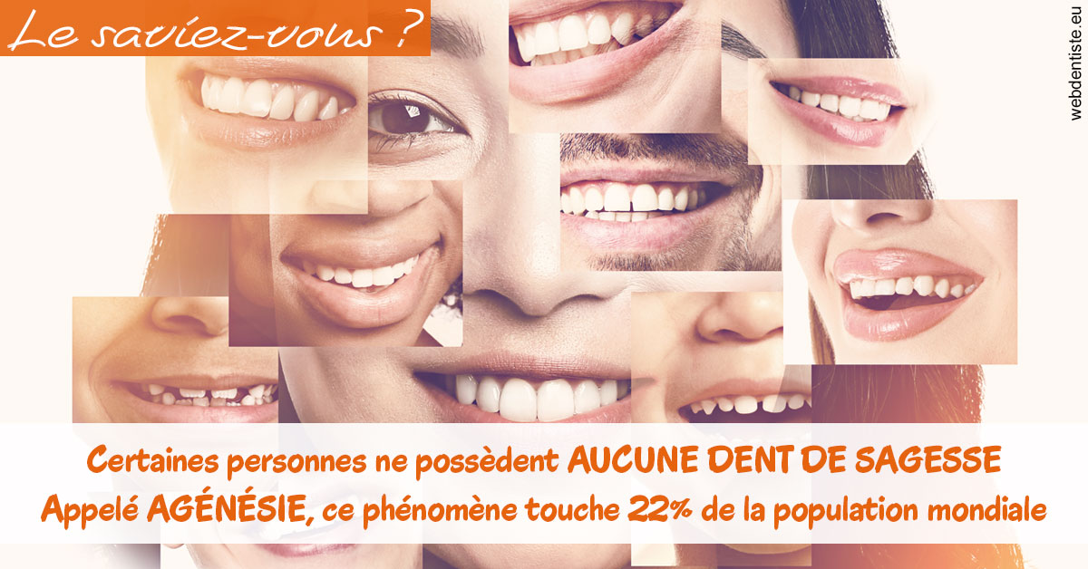 https://selarl-smile.chirurgiens-dentistes.fr/Agénésie 2