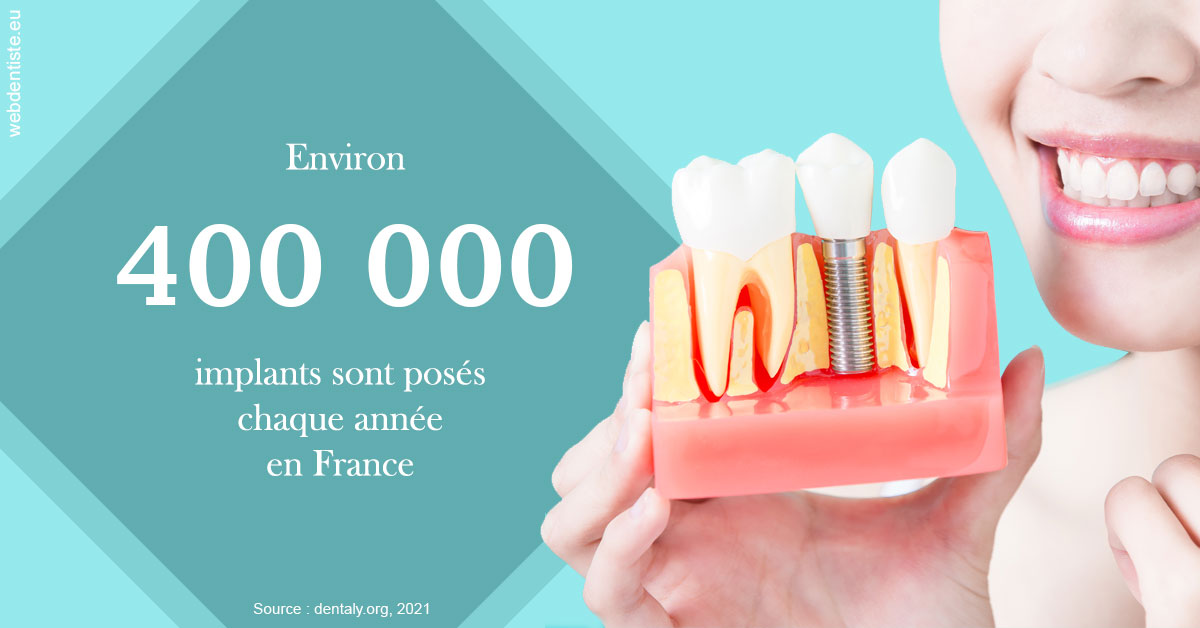 https://selarl-smile.chirurgiens-dentistes.fr/Pose d'implants en France 2